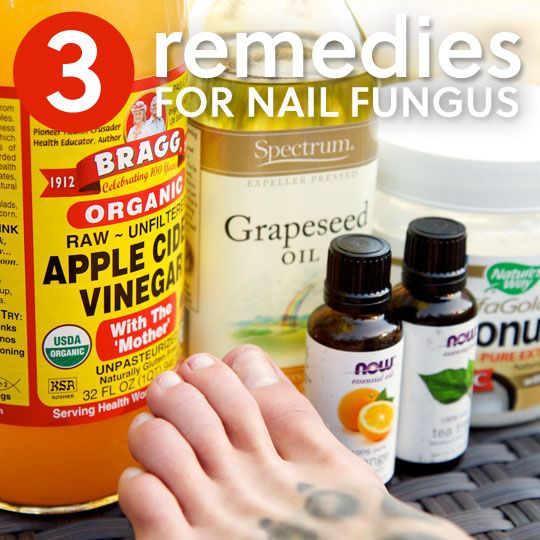 3 Accueil simples remèdes pour Toenail Fungus- vous débarrasser de votre champignon de l'ongle à la maison.