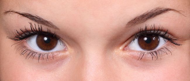 Natural Ayurveda remèdes maison remède pour l'irritation dans les yeux
