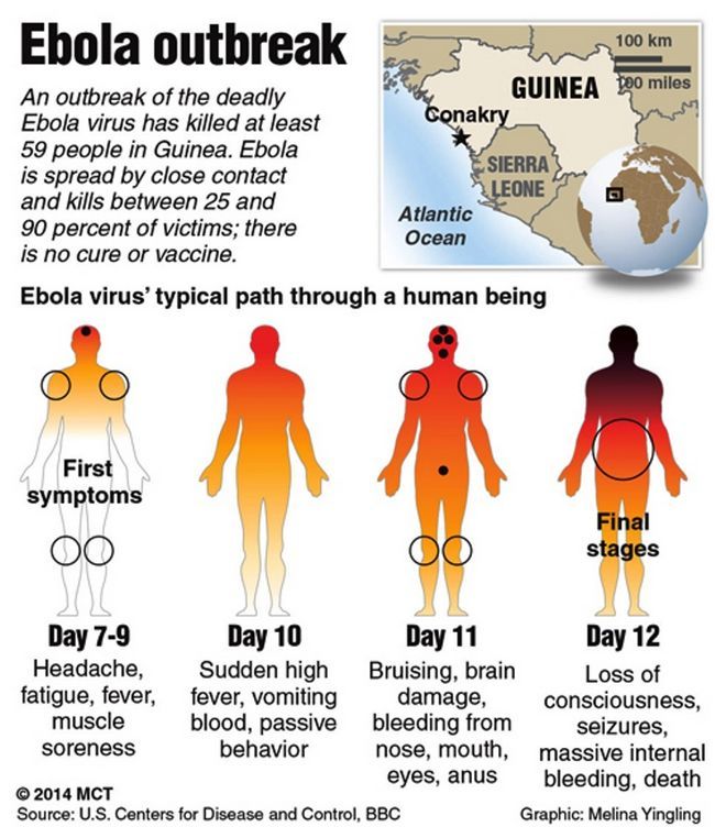 Attention: tout ce que vous devez savoir sur le virus Ebola
